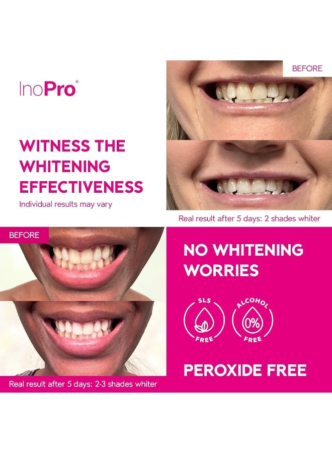 InoPro Teeth Whitening Strips 21 Treatments Kit - Teeth Whitener, Peroxide Free, Enamel Safe Green Whitestrips, Deep Stains Removal - Instant Teeth Whitening Without The Harm (42 Strips) - Image 2